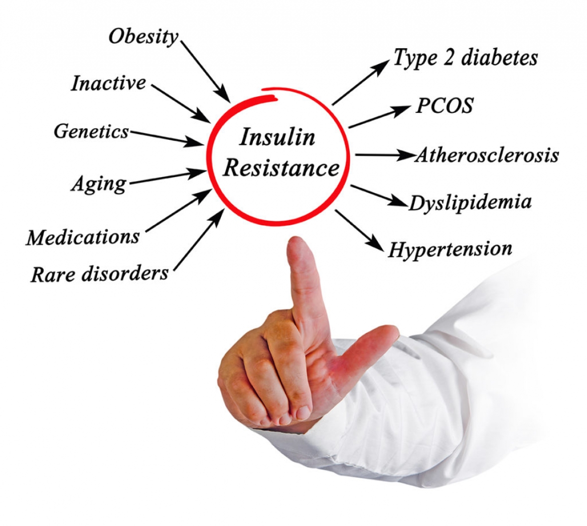 Insulin Resistance and Hypothyroidism Connection